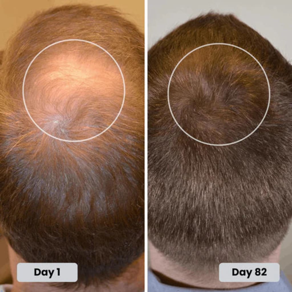 Red Light Therapy Cap for Hair Growth Treatment