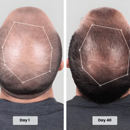Red Light Therapy Cap for Hair Growth Treatment